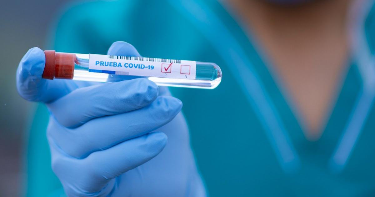 Ya son 83 casos de COVID-19 en el FPC: Así está el panorama con la pandemia