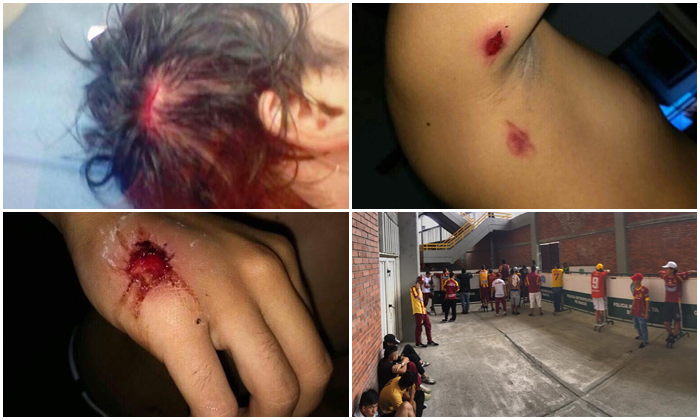 Hinchas del DEPORTES TOLIMA denunciaron presuntos excesos de la Policía en el juego ante Millonarios