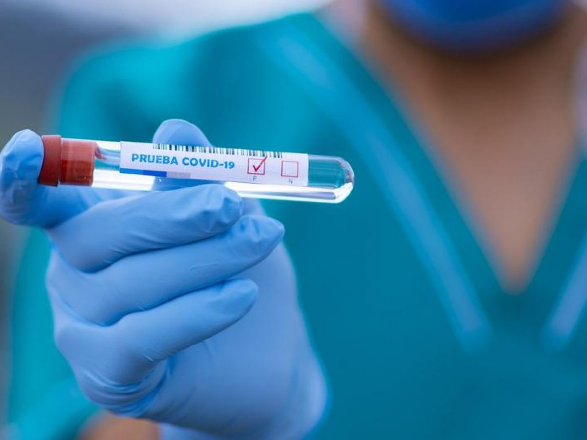 Dieciséis nuevos casos de contagio de COVID-19 en el FPC: Así lo confirmaron estos clubes